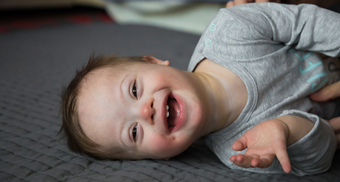 Baby with down syndrome lying on the floor laughing and smiling